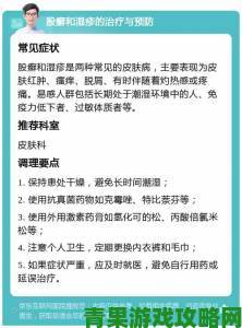 淑芬两腿间又痒痒的预防方法那些医生不会主动告诉你的细节